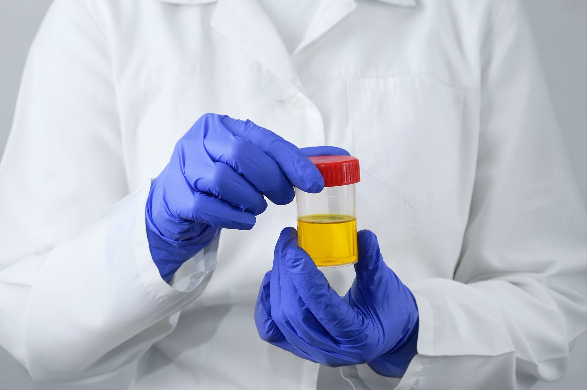 Laboratory doctor with a can of urine tests in his hands on a white background.